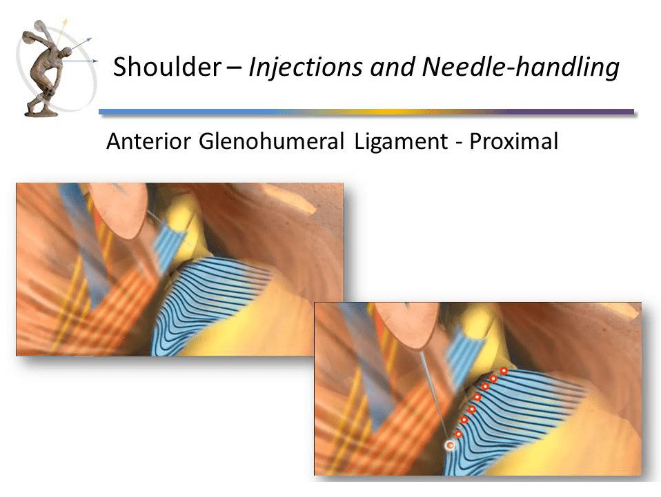 Prolotherapy Course Modules
